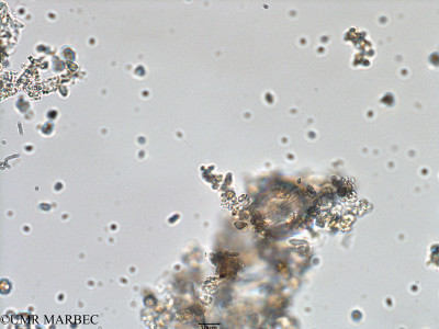 phyto/Bizerte/bizerte_bay/RISCO February 2015/Diplopsalid 7 (ancien Baie_T1-A_Dino d-1).tif(copy)_thumb.jpg